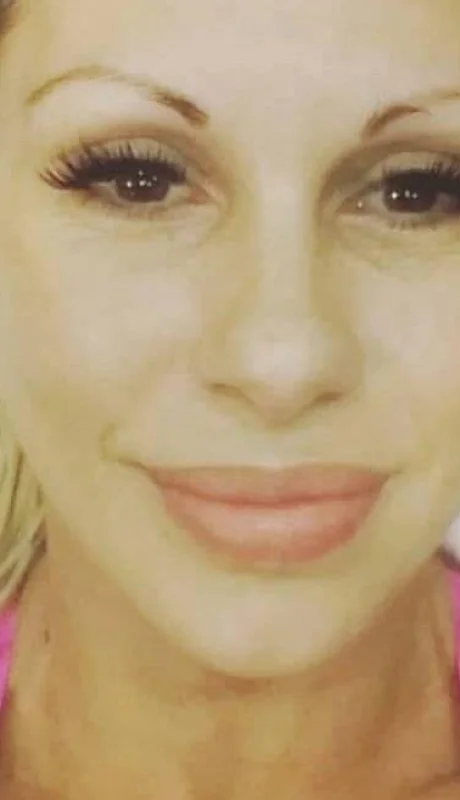 monica-farro-instagram-cara-operaciones