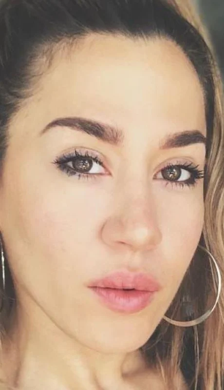 jimena-baron-operaciones-en-la-cara