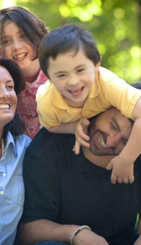 1.-Síndrome-de-Down