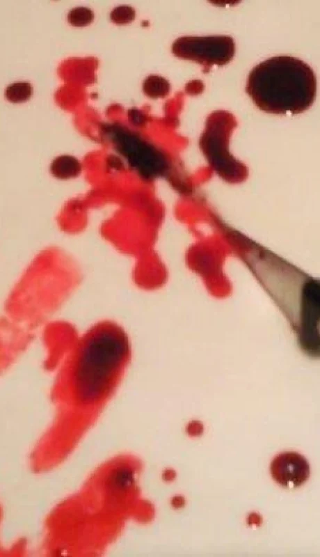 sangre-cumpleaños-apuñalado-las-heras-mendoza-policiales