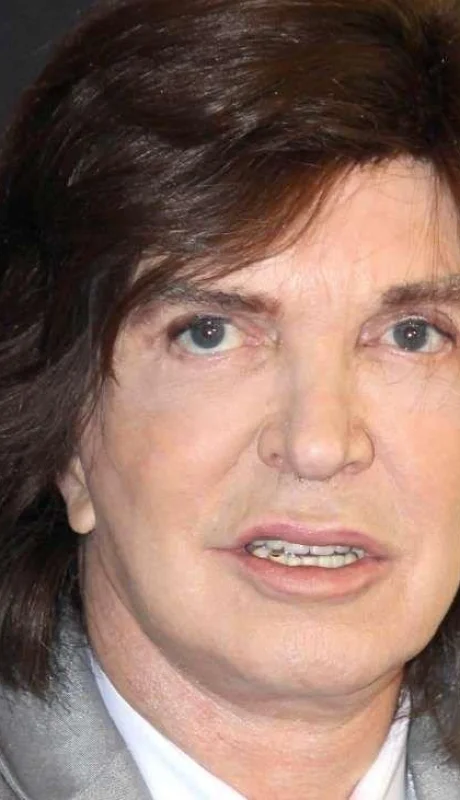 murio-camilo-sesto-a-los-72-años-madrid-problemas-renales