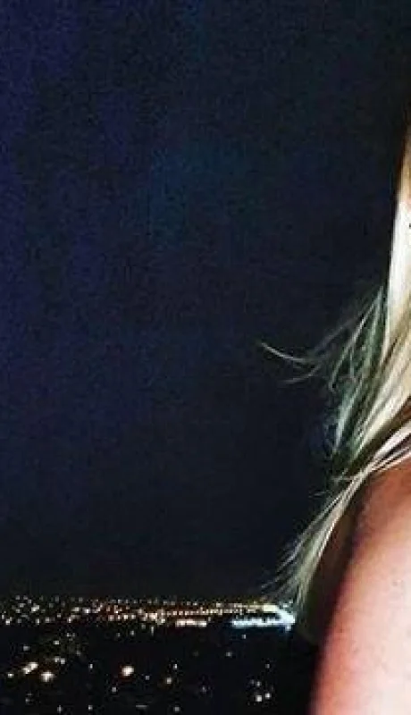 nicole-neumann-instagram-fotos-cola-picadura-insecto-67