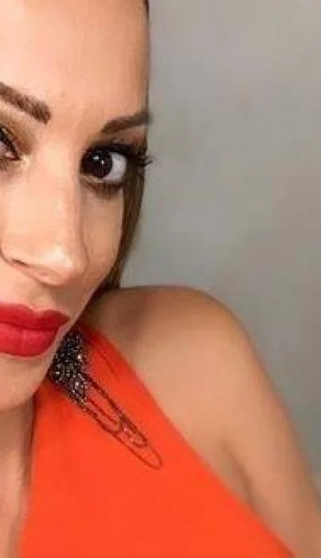 noelia-marzol-fotos-operaciones-antes-después-9-