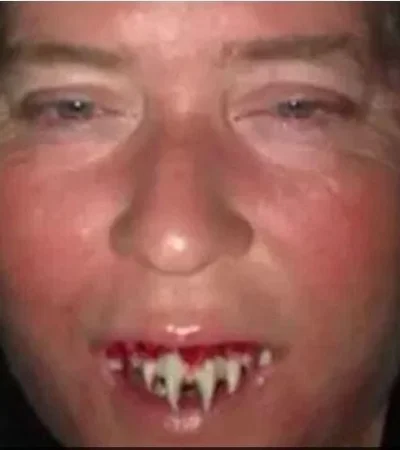 disfraz-de-zombie-para-halloween