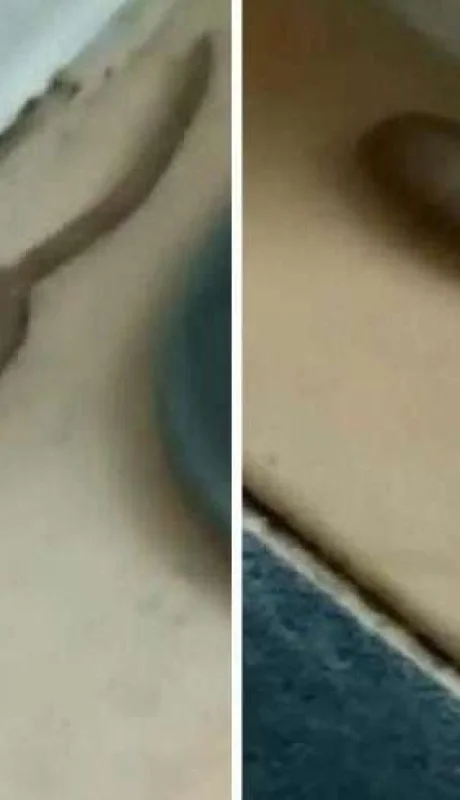 larva-de-mosca-zángano