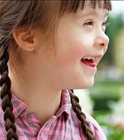 síndrome-de-down-940x430