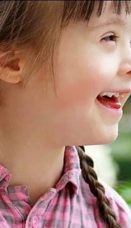 síndrome-de-down-940x430