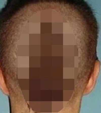 corte-pelo-peluquero-rata-ratón-colita-foto-caso-barrio-2