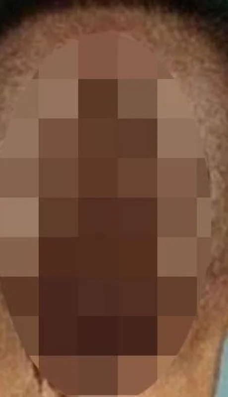 corte-pelo-peluquero-rata-ratón-colita-foto-caso-barrio-2