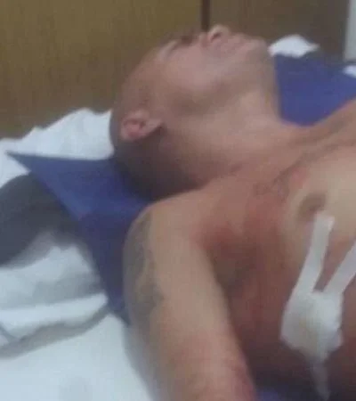 hiena-barrios-agresor-ataque-fotos-video