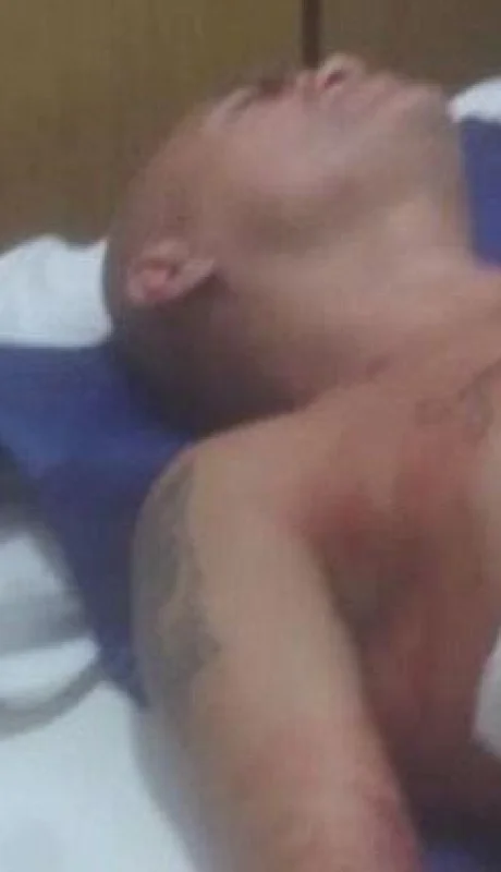 hiena-barrios-agresor-ataque-fotos-video