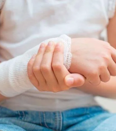 quemaduras-niños-mendoza-accidente-policiales