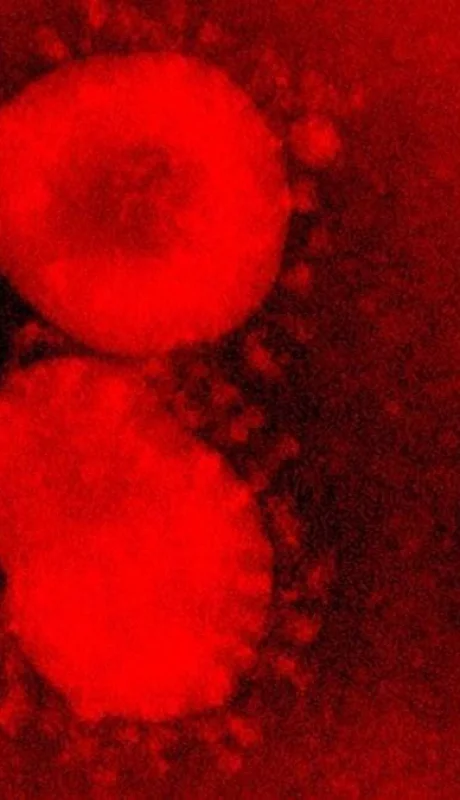 Coronavirus-2