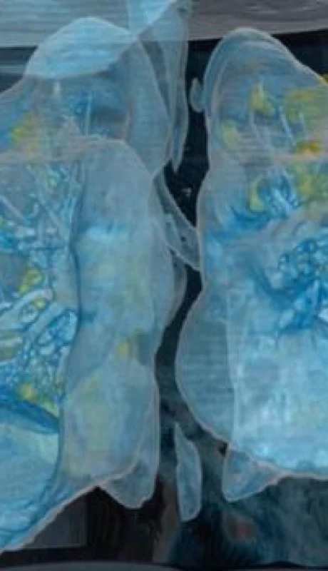 coronavirus-video-pulmones