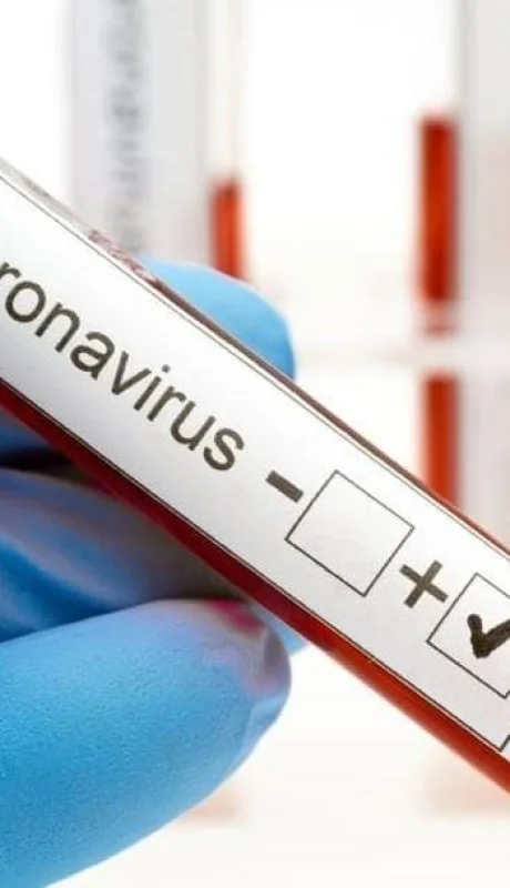 coronavirus-Mendoza