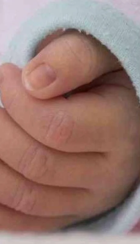 bebé-maltrato-padre-sacudió-nena