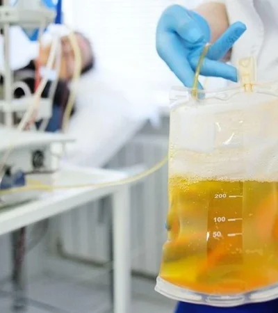 plasma-tratamiento-argentina