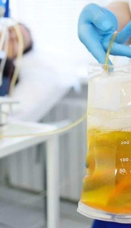 plasma-tratamiento-argentina