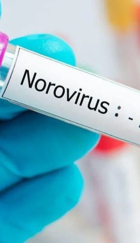 Norovirus