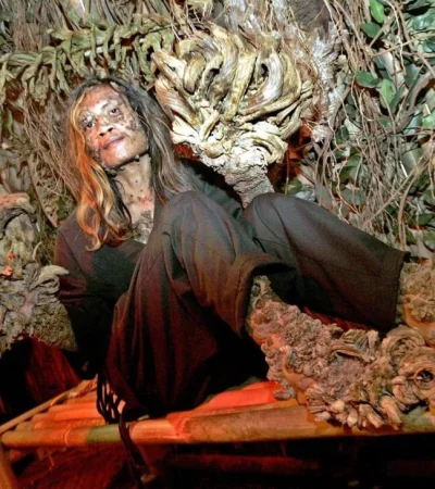 hombre_a?rbol_si?ndrome