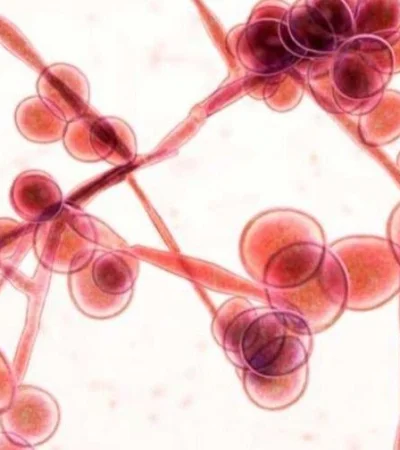 candida-auris-hongo-brasil