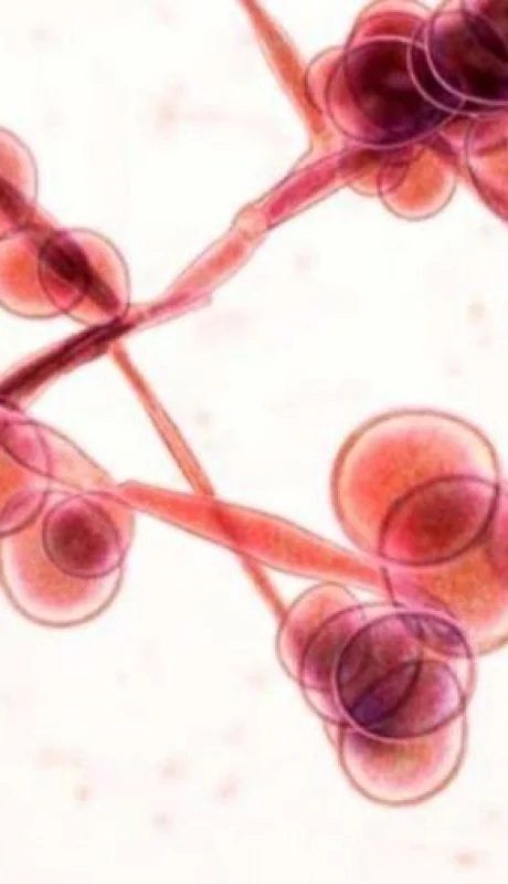 candida-auris-hongo-brasil