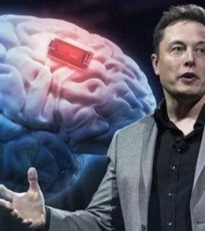 elon-musk-neuralink-chip