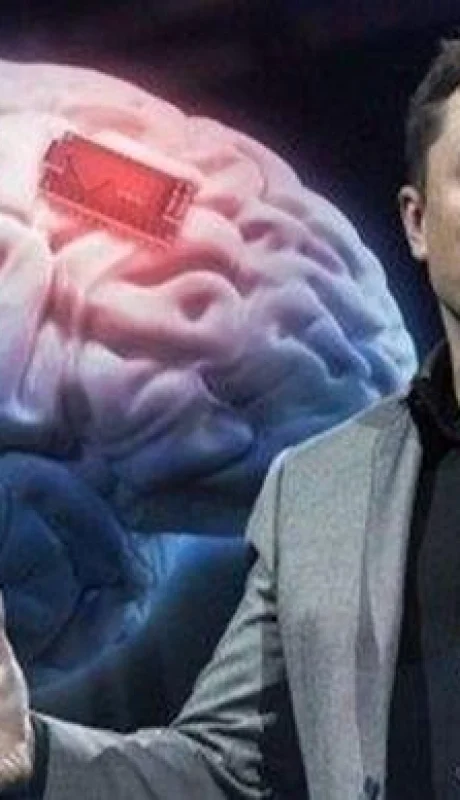 elon-musk-neuralink-chip