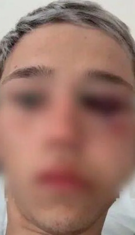 rugbiers-golpean-menor-mendoza