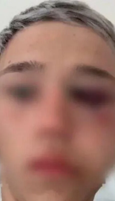 rugbiers-golpean-menor-mendoza