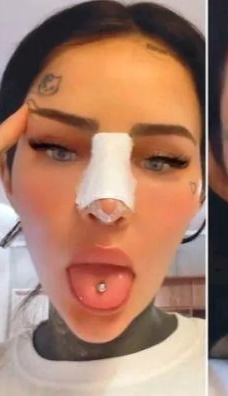 cande-tinelli-operaciones-nariz-video--fotos