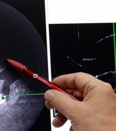 visión-ojo-ocular-operación-reino-unido