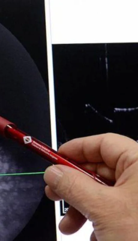 visión-ojo-ocular-operación-reino-unido