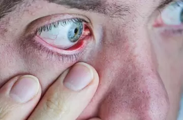 Alertan sobre los riesgos de la operación para cambiar los colores de los ojos