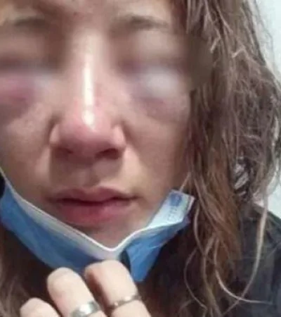 joven-desfigurada-jpg.