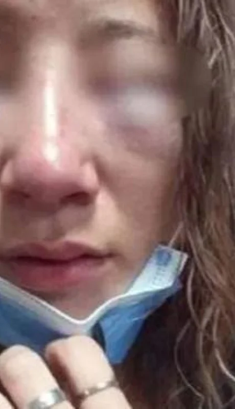 joven-desfigurada-jpg.