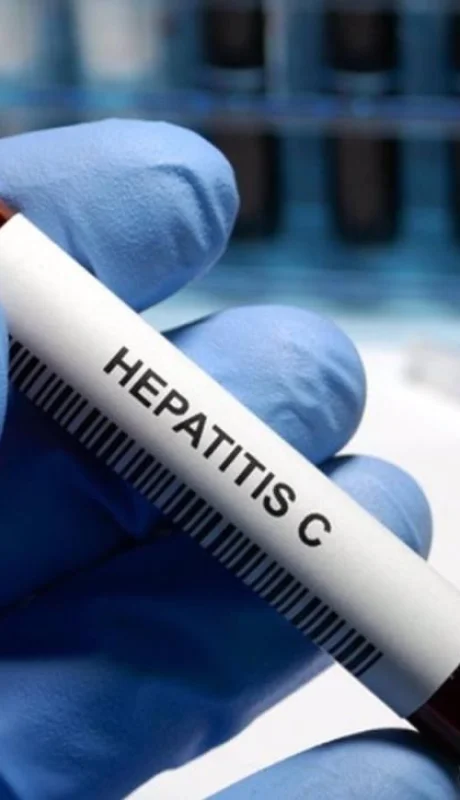 hepatitis-jpg.