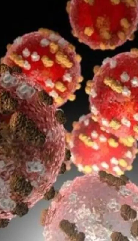 viruela-del-mono-jpg.