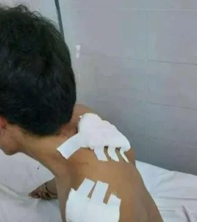 joven-apunalado-jpg.