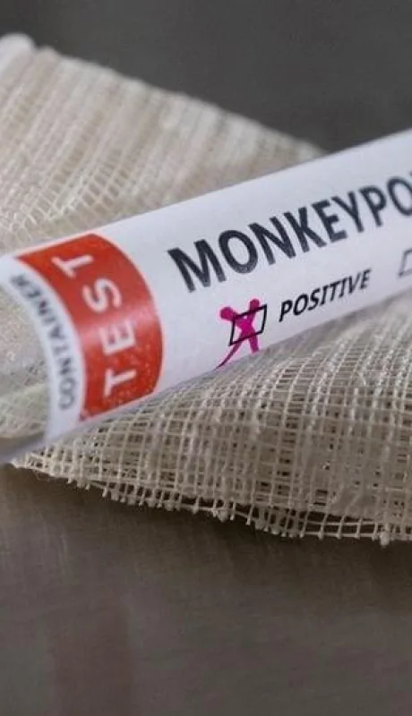 viruela-del-mono-jpg.