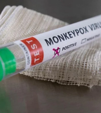 viruela-del-mono-jpg.