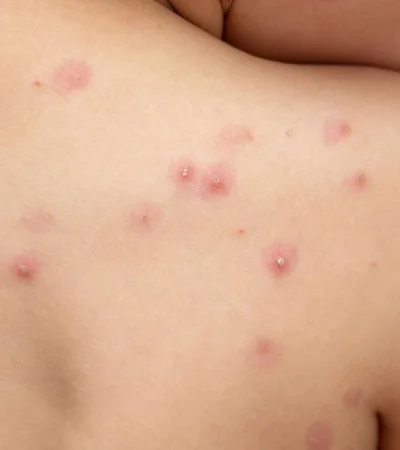 imagen-destacada-blog3-1-png.