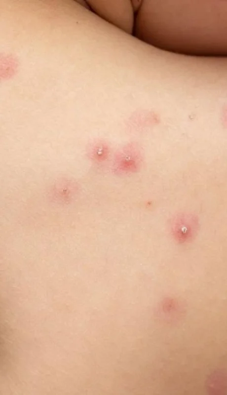 imagen-destacada-blog3-1-png.