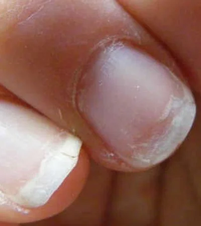 cuidado-de-las-unas-quebradizas-de-manera-natural-jpg.