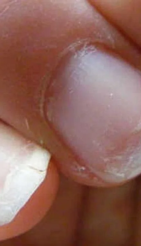 cuidado-de-las-unas-quebradizas-de-manera-natural-jpg.