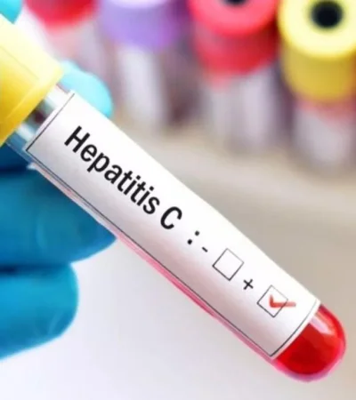 hepatitis-jpg.