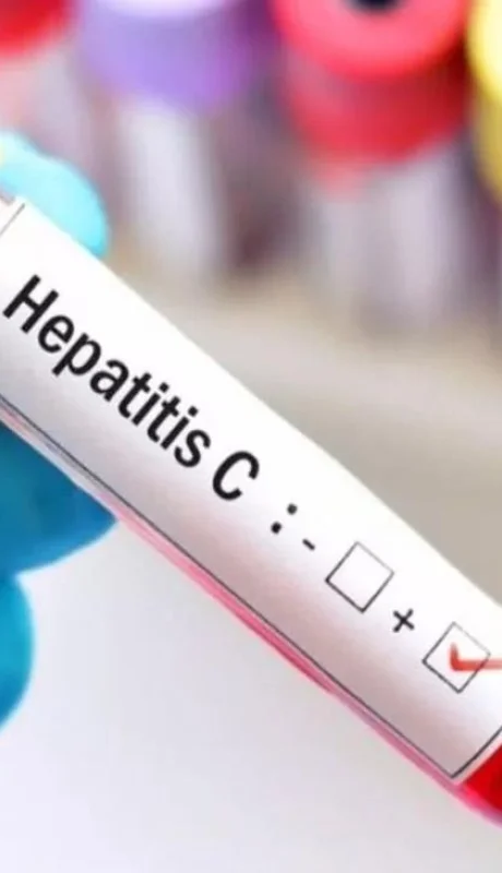 hepatitis-jpg.