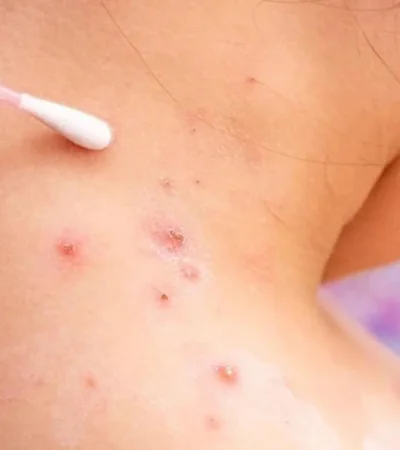 sanidad-confirma-alicante-primer-jpg.