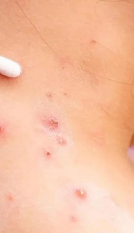 sanidad-confirma-alicante-primer-jpg.