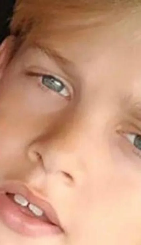 archie-battersbee-muerte-cerebral-g20220614-1371437-jpg.